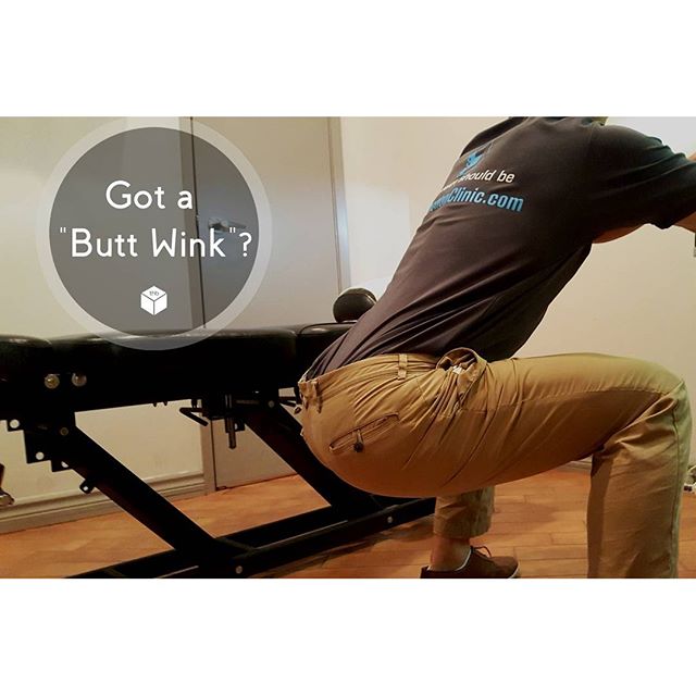 What is Butt Wink?The &;butt wink&; or posterior pelvic tilt - the pelvis pulls the lumbar spine into flexion or rounding of the low back putting you in a vulnerable position.  You want to remember to - keep an arch - prevent that spinal rounding.  Otherwise you risk damaging ligaments, causing disc irritations or herniations. What Causes Butt Wink?A number of factors combined together can cause the butt wink which leaves your low back and hips vulnerable. This can be hip capsule tightness, hip flexor tightness, knee issues, ankle or even big toe limitations.One limitation is where the head of the femur articulates with the acetabulum.  The only way to go deeper is to round the pelvis and the lumbar spine - this is anatomical - this will be different between individuals.Stretching can help partially - think of the hamstring, it crosses both the hip and the knee joint - as you bend your knee flexes, and the overall tension from the hamstrings does not usually prevent you from going into a deeper squat.You can improve your hip flexion mobility over time.You can also improve your squat depth over time.What can we do?Motor control - motor control is imperative - the squat is a complex compound exercise that forces muscles to work in concert.  As you improve your proficiency - your squat will improve. The mobility exercises I&;ve posted previously can help - but its best to first figure out what you need to work on. Then focus your work there.  Work smart. Check out my future posts for more mobility drills.